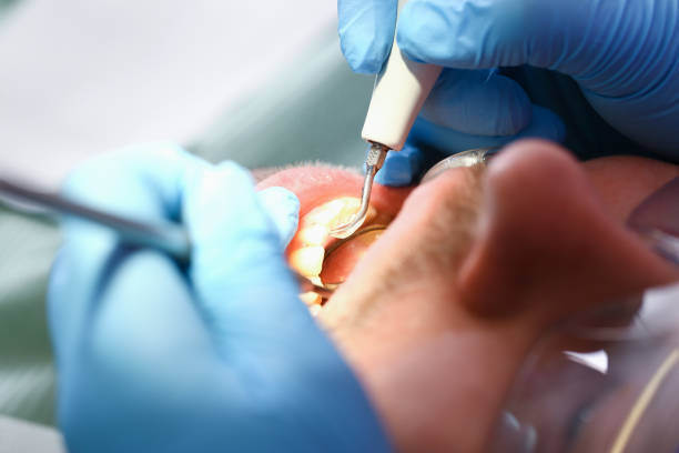 Dentist for Dental Trauma in IL